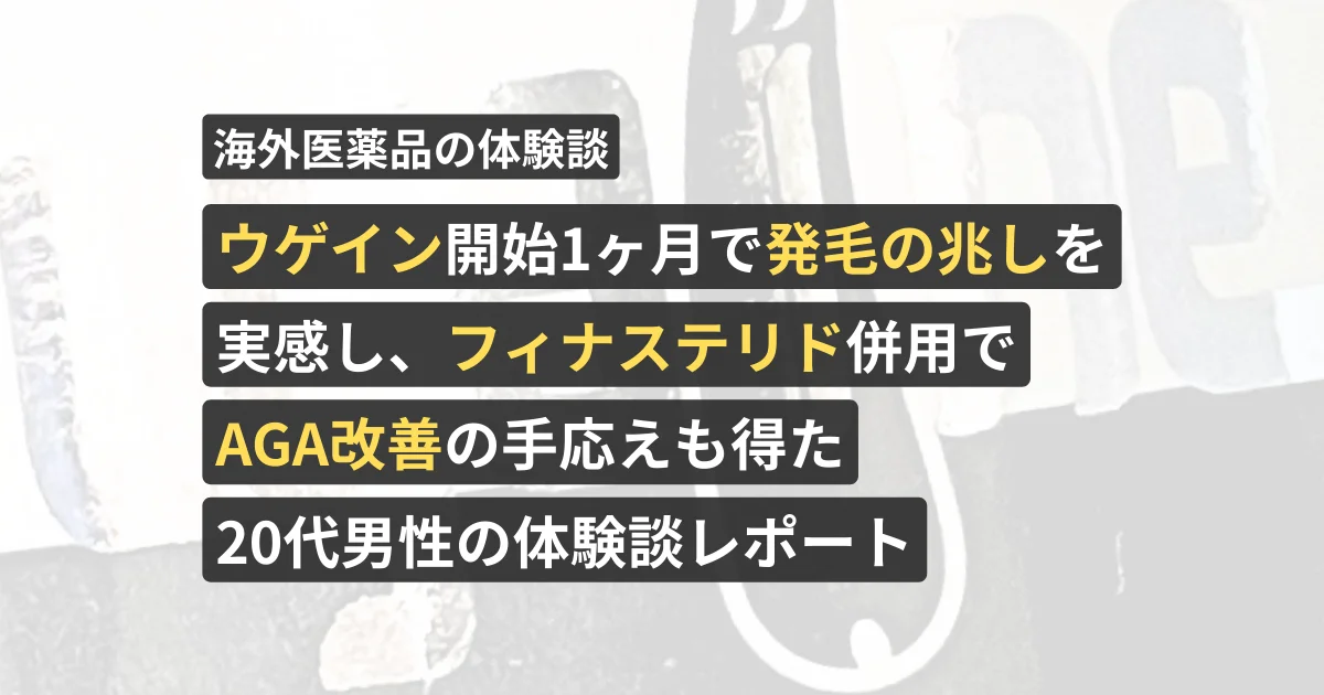 ウゲイン開始1ヶ月で発毛の兆しを実感し、フィナステリド併用でAGA改善の手応えも得た20代男性の体験談レポート【看護師が確認済み】