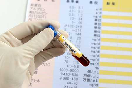 表参道ウィルAGAクリニックのDNA検査